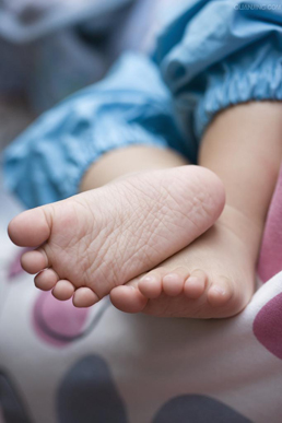 預(yù)防骨骼彎曲變形 預(yù)防骨骼彎曲變形