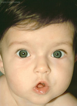 新生寶寶口腔板牙